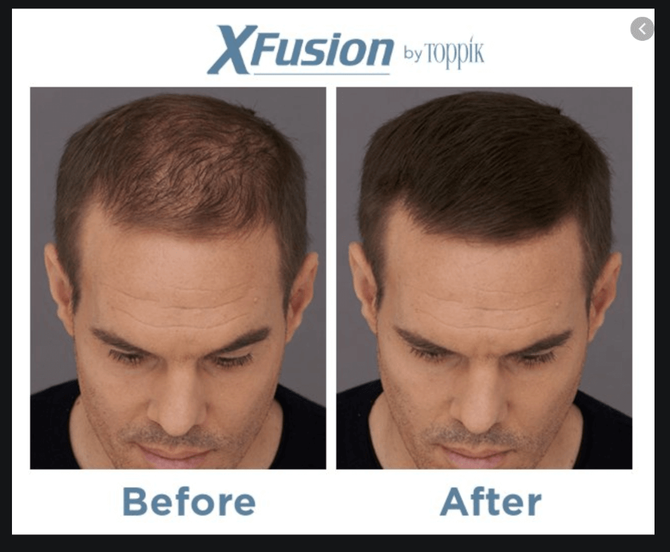 X-FUSHION KERATIN HAIR FIBERS - Hermosa Hair Extensions